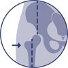 Biomechanische correctie