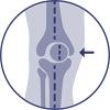 Biomechanische correctie