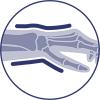 Immobilisatie